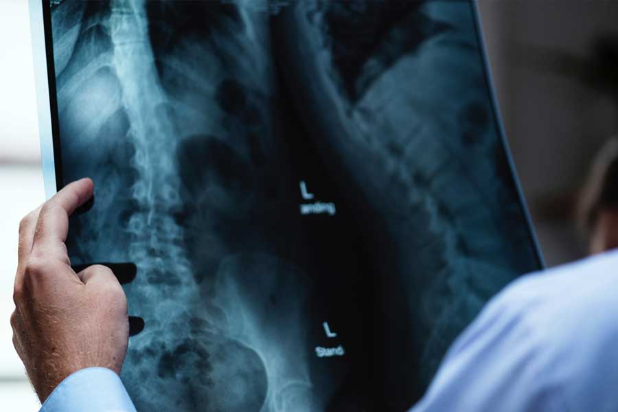 Perché scegliere le radiografie a domicilio?